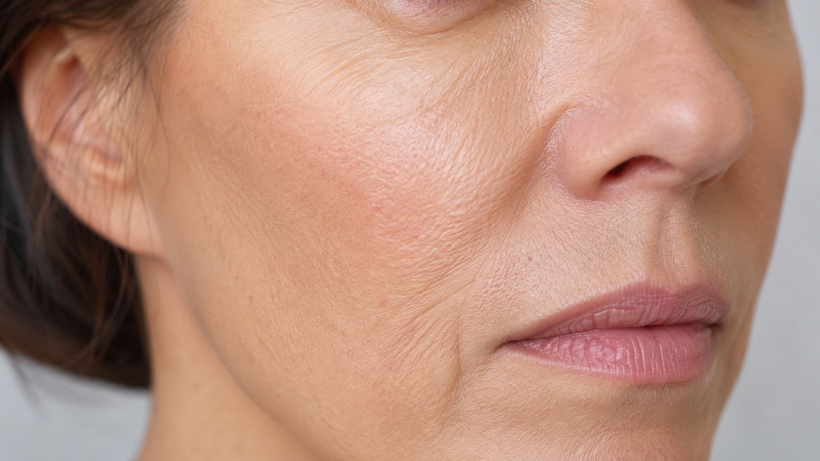 Close up skin texture and collagen loss after 40