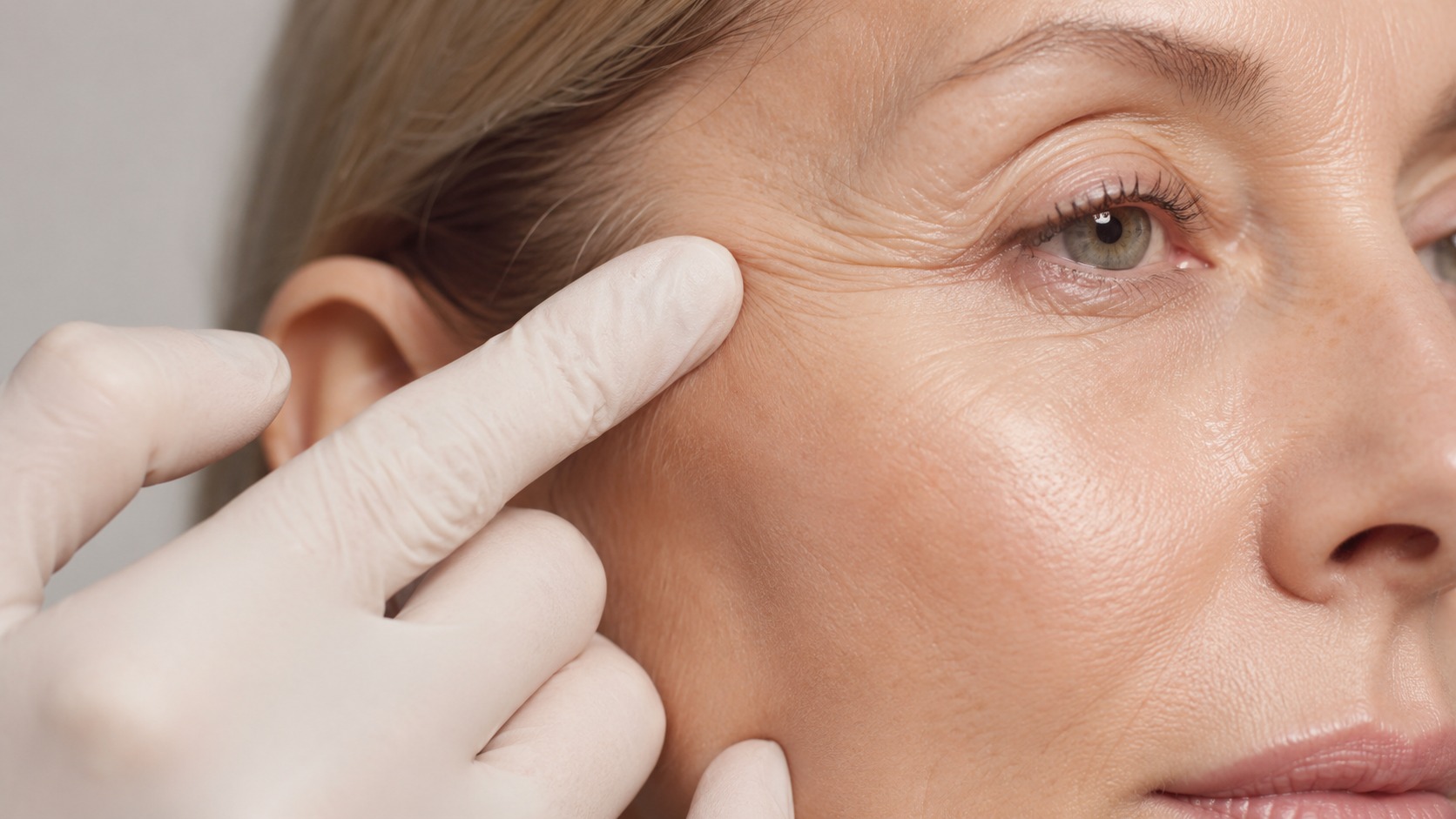 Collagen and elastin skin structure illustration
